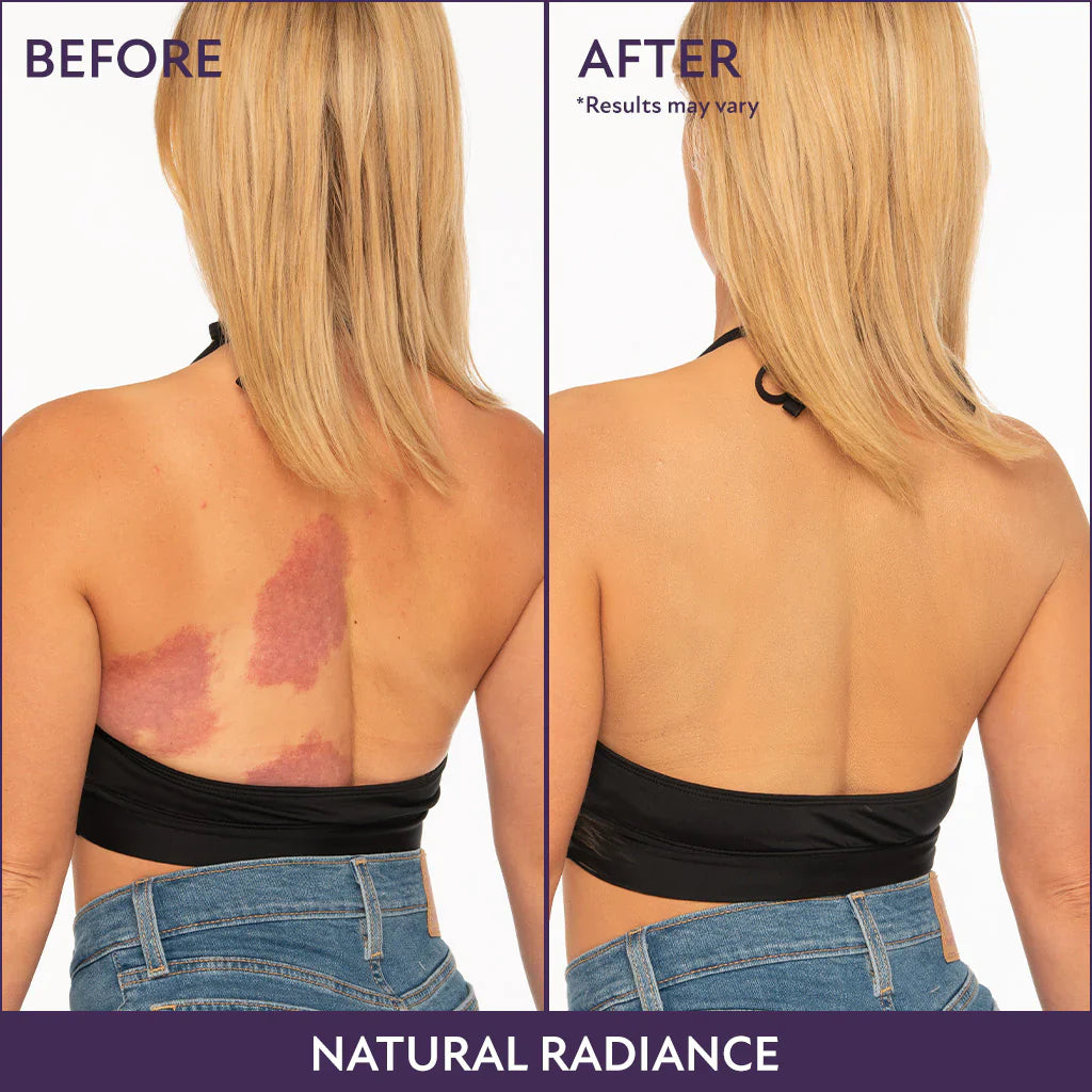 Blunie™ | Body Coverage Perfector